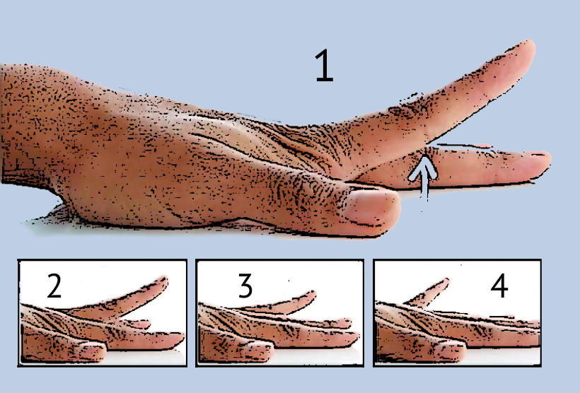 Claw discount hand exercises