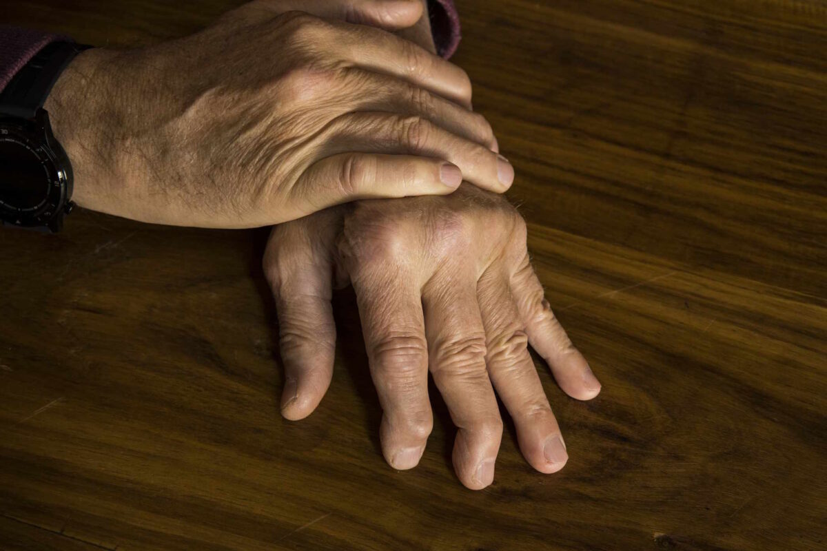 Arthritis Symptoms 6 Misconceptions Fort Worth Doctors