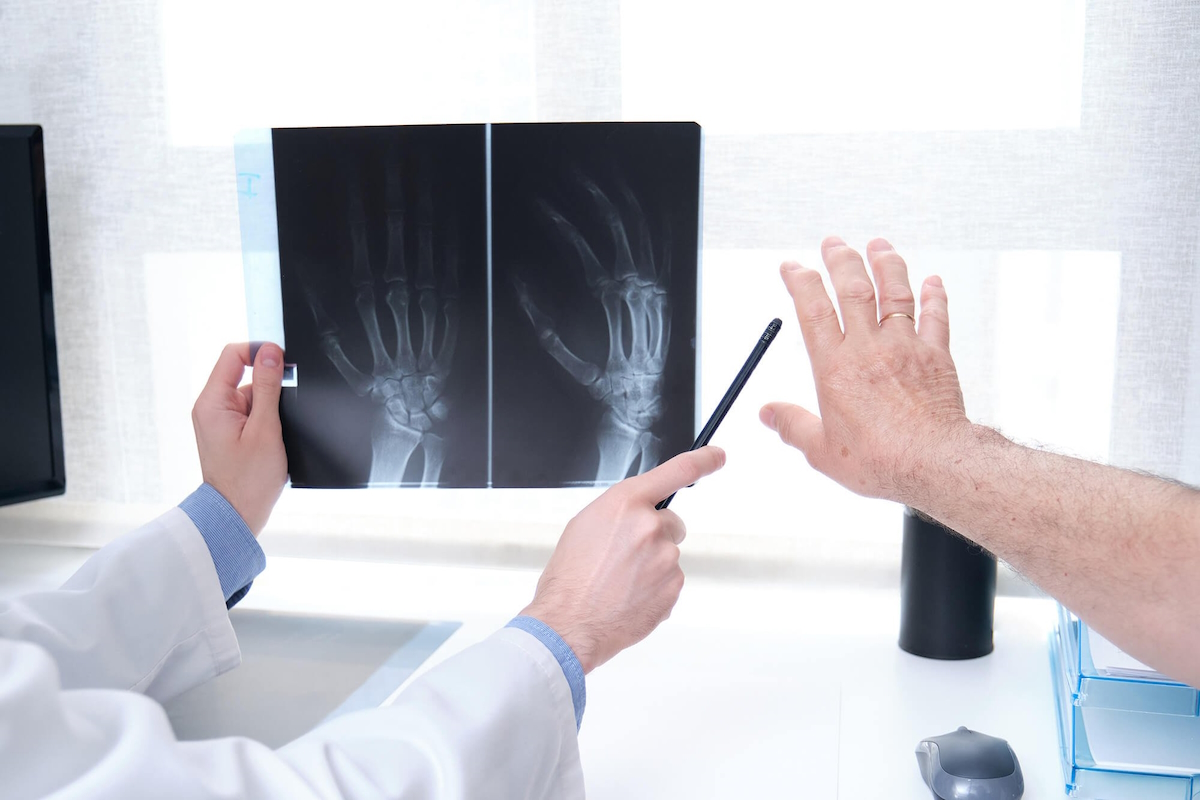 orthopedic hand doctor x ray hands patient with arthritis