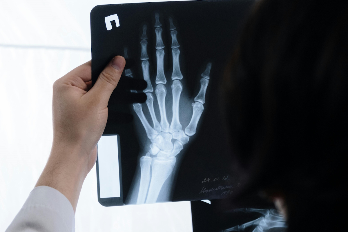 orthopedic surgery hand xray