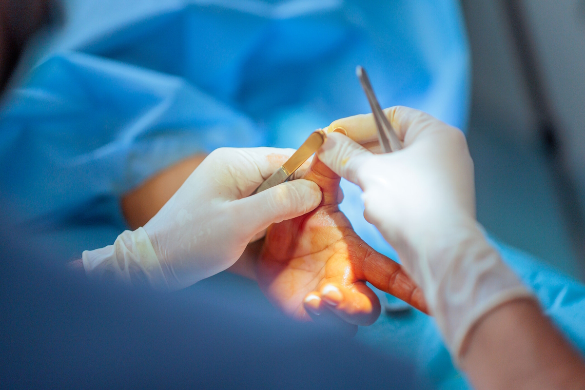 thumb arthritis surgery orthopedic surgeon holding patient hand