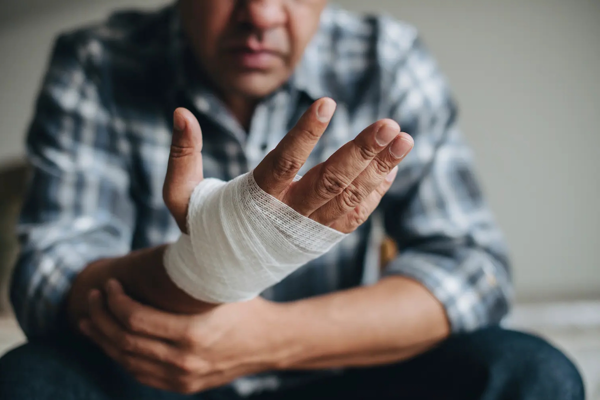 hand surgery recovery man with wrapped hand