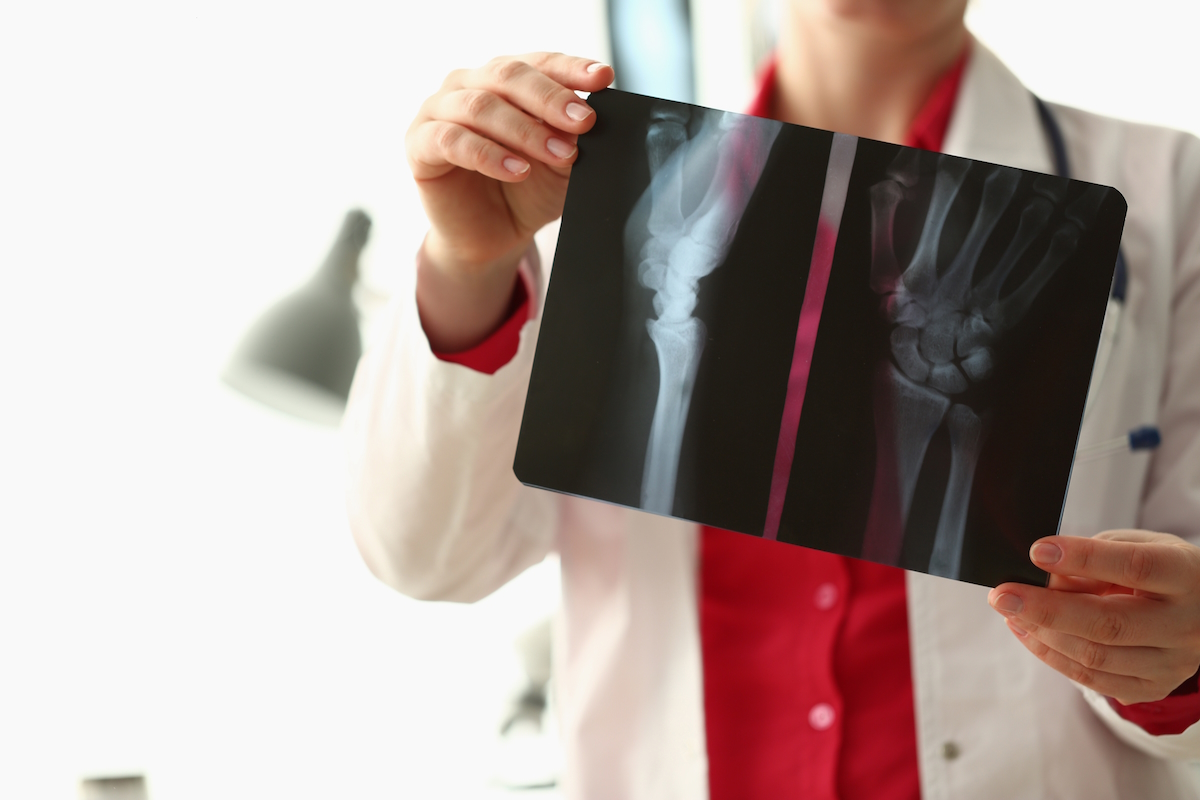jammed finger orthopedic hand doctor examines x ray patient hand